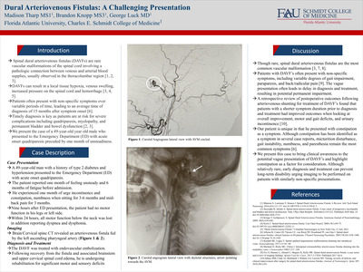 Dural Arteriovenous Fistulas: A Challenging Presentation