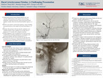 Dural Arteriovenous Fistulas: A Challenging Presentation by Madison Tharp, Brandon Knopp, and George Luck