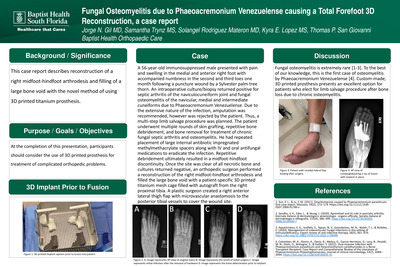 Fungal Osteomyelitis due to Phaeoacremonium Venezuelense causing a Total Forefoot 3D Reconstruction, a case report