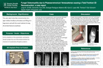 Fungal Osteomyelitis due to Phaeoacremonium Venezuelense causing a Total Forefoot 3D Reconstruction, a case report