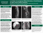 Low Anterior Cervical Approach Without Sternotomy or Clavicle Resection for Upper Thoracic Vertebra Corpectomy by Sofia Kelly, Denis Baici, Phillip Johansen, Nikolas Echeverry, Koushik Mantripragada, Timothy Miller, and Brian Snelling
