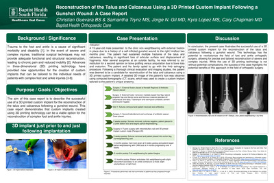 Reconstruction of the Talus and Calcaneus Using a 3D Printed Custom Implant Following a Gunshot Wound: A Case Report