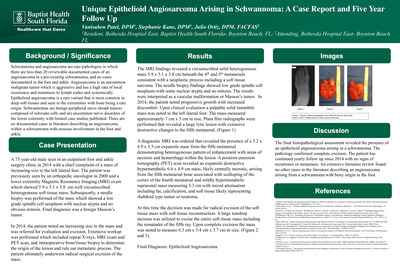 Unique Epithelioid Angiosarcoma Arising in Schwannoma: A Case Report and Five Year Follow Up