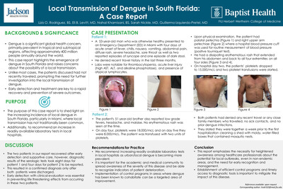 Local Transmission of Dengue in South Florida: A Case Report