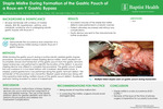Staple Misfire During Formation of the Gastric Pouch of a Roux-en-Y Gastric Bypass
