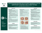 Lateral Tarsoconjunctival Onlay Flap for Paralytic Lagophthalmos and Lower Eyelid Ectropion in Facial Nerve Palsy: A Surgical Technique