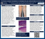 The Pseudo-Koebner Phenomenon of Epidermodysplasia Verruciformis in Tattooed Skin by Jessica Riopedre
