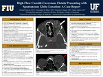 High-Flow Carotid-Cavernous Fistula Presenting with Severe Globe Luxation: A Case Report by Michael Sinnott